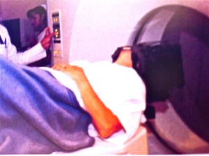 tratamiento para el tumor hipofisiario por rayos Gama Knife